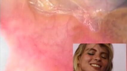 Эндоскоп в заднем проходе русских девушек