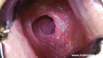 Анальный расширитель и мастурбация анала