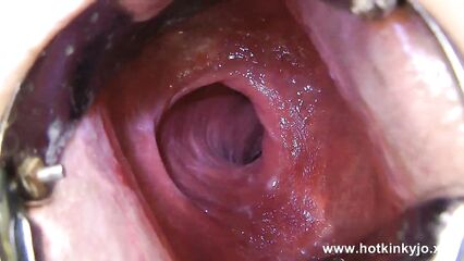 Анальный расширитель и мастурбация анала